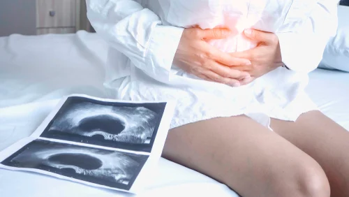 gynecologist Noida gynecologist Noida